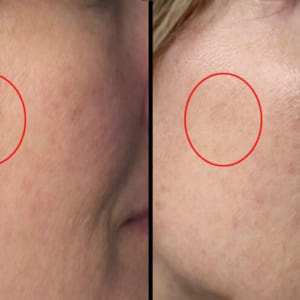 Timeless-Pure-Natural-Serum-Vitamin-B5-Hyaluronic-Acid