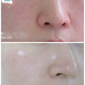 serum-chong-lao-hoa-timeless-pure-natural-serum-6