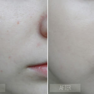 tay-te-bao-chet-tra-xanh-stives-green-tea-scrub-13