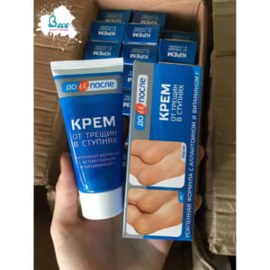 kem-tri-nut-ne-got-chan-cua-nga-apteka