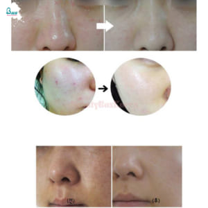 goi-serum-tri-mun-madagascar-centella-asiatica-han-quoc