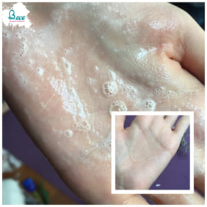 combo-la-roche-posay-kem-duong-giam-mun-40ml-gel-rua-mat-cho-da-dau-50ml