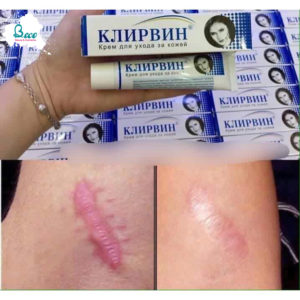 Kem Mờ Sẹo Klirvin