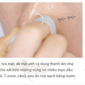 Thanh Lăn Mụn Đầu Đen