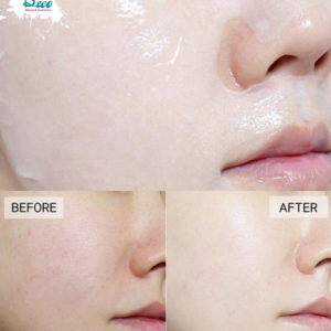 Mặt Nạ Mediheal Teatree