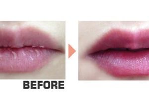 mặt nạ ngủ môi