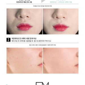 Che Khuyết Điểm FM