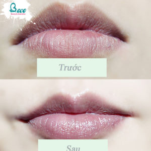 Tẩy Da Chết Môi Elf