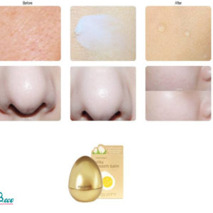 Kem Dưỡng Quả Trứng