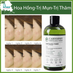 Nước Hoa Hồng Trị Mụn 3 In 1 Caryophy Portulaca Toner 300ml