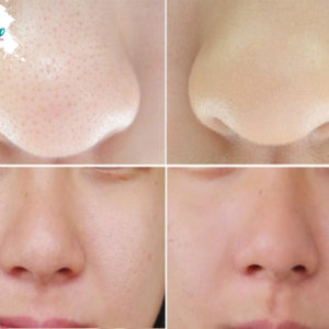 Kem Dưỡng Trà Xanh