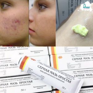 Kem Trị Mụn Lưu Huỳnh