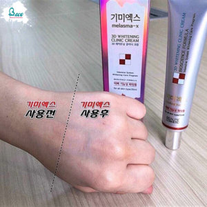 Kem Trị Thâm Nám Melasma-x 3D