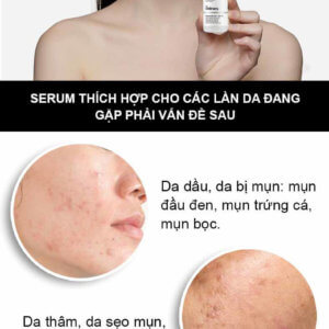 Serum Trị Mụn Và Thâm The Ordinary Niacinamide 10% + Zinc 1% 8
