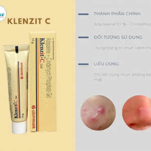 Kem trị mụn ngừa thâm Klenzit C